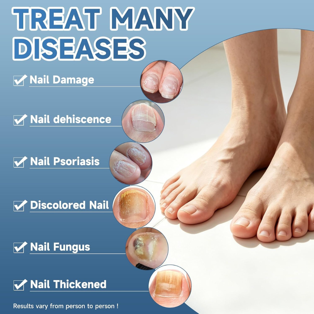 Antifungal Nail Repair Solution