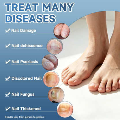 Antifungal Nail Repair Solution