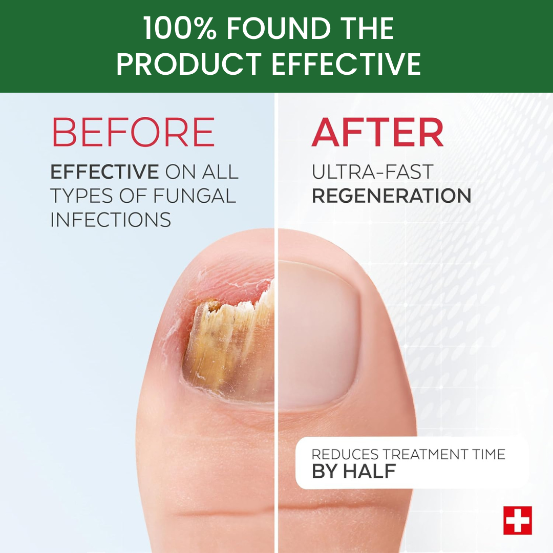 Antifungal Nail Repair Solution