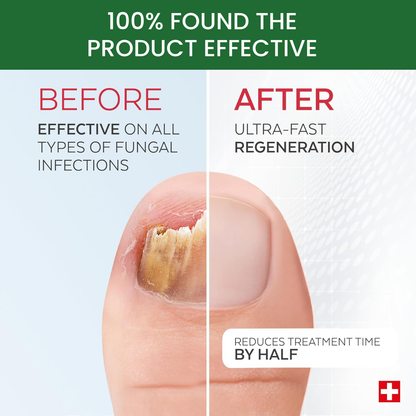 Antifungal Nail Repair Solution