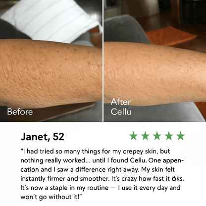 Crepey Skin Repair Cream