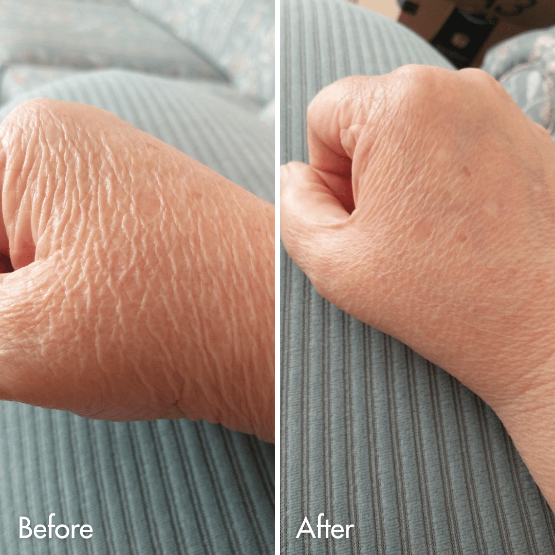 Crepey Skin Repair Cream