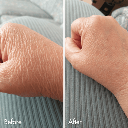 Crepey Skin Repair Cream